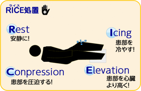 スポーツで役立つrice処置について スポーツ専門 しみずばし鍼灸整骨院