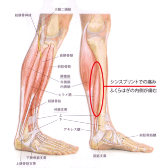 陸上 マラソン スポーツ専門 しみずばし鍼灸整骨院